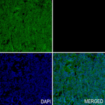 ALDH16A1 Rabbit Monoclonal Antibody