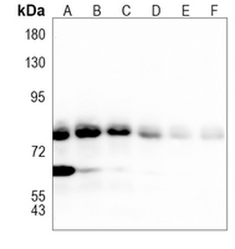 ACSL4 Rabbit Monoclonal Antibody