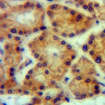 ACSL4 Rabbit Monoclonal Antibody