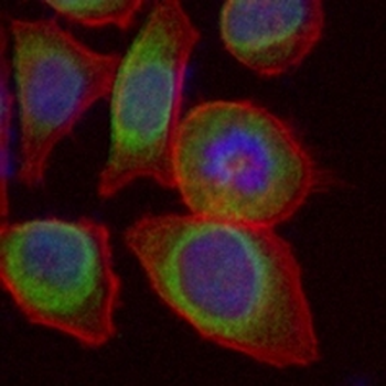 ACSL4 Rabbit Monoclonal Antibody