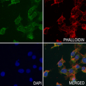 GRSF1 Rabbit Monoclonal Antibody