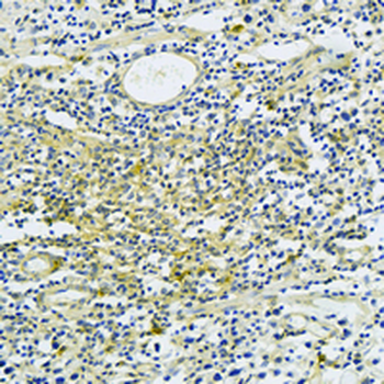 AP1G1 Rabbit Monoclonal Antibody