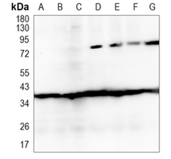 ACAT2 Rabbit Monoclonal Antibody