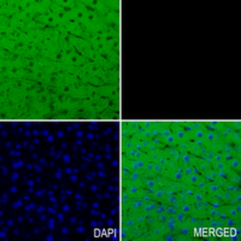 ACAT2 Rabbit Monoclonal Antibody