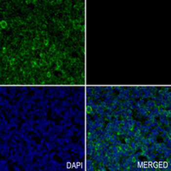 MNX1 Rabbit Monoclonal Antibody