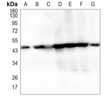 ACAA2 Rabbit Monoclonal Antibody