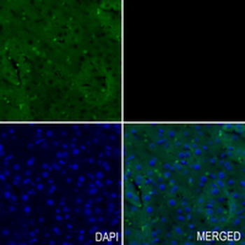 ACAA2 Rabbit Monoclonal Antibody