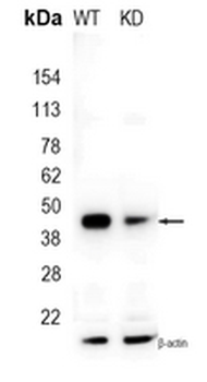 ACAA2 Rabbit Monoclonal Antibody