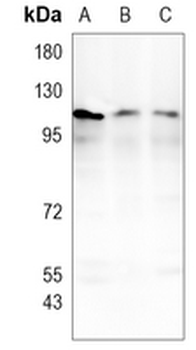 PKN2 Rabbit Monoclonal Antibody