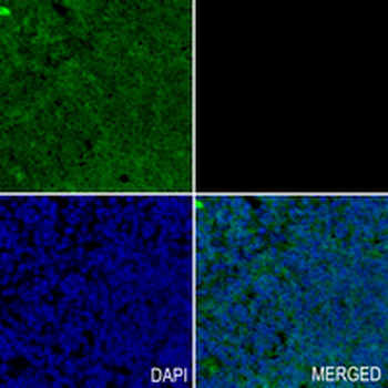 PKN2 Rabbit Monoclonal Antibody