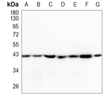 Smooth Muscle Actin Rabbit Monoclonal Antibody