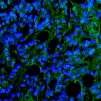 Smooth Muscle Actin Rabbit Monoclonal Antibody