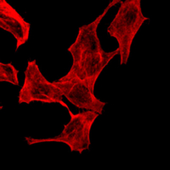 Smooth Muscle Actin Rabbit Monoclonal Antibody
