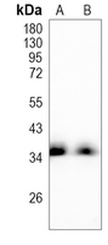 MSI2 Rabbit Monoclonal Antibody