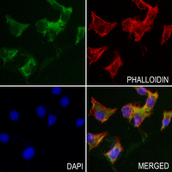 MSI2 Rabbit Monoclonal Antibody