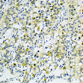 ERp19 Rabbit Monoclonal Antibody