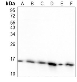 LC3-I/II Rabbit Monoclonal Antibody