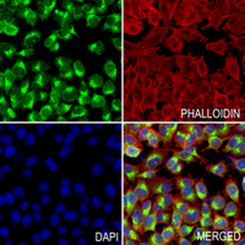 LC3-I/II Rabbit Monoclonal Antibody