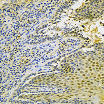 MTAP Rabbit Monoclonal Antibody