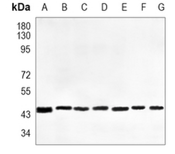 DNAJA4 Rabbit Monoclonal Antibody