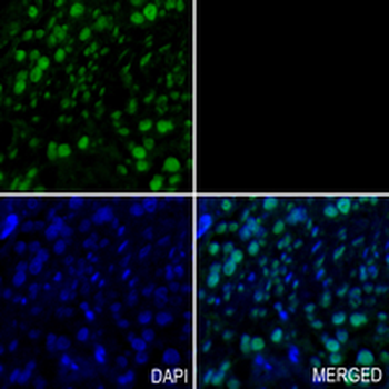 SAP61 Rabbit Monoclonal Antibody