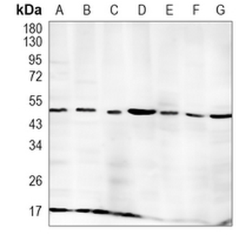 Fukutin Rabbit Monoclonal Antibody