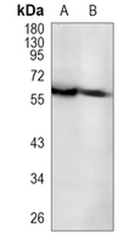 TUB Rabbit Monoclonal Antibody