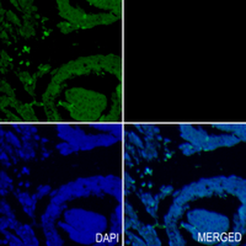 TUB Rabbit Monoclonal Antibody