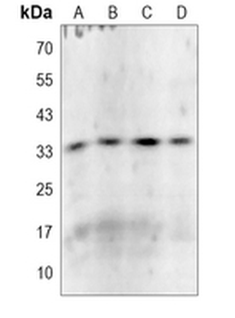 MDH1 Rabbit Monoclonal Antibody