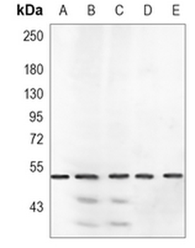 ROR beta Rabbit Monoclonal Antibody