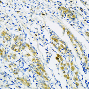 WASF2 Rabbit Monoclonal Antibody