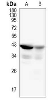 RBMXL2 Rabbit Monoclonal Antibody
