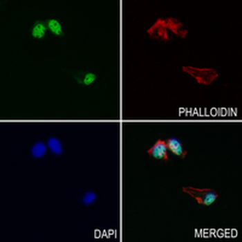 RBMXL2 Rabbit Monoclonal Antibody