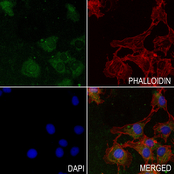 DNAJC15 Rabbit Monoclonal Antibody