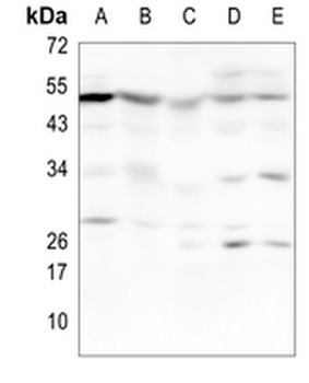 CaMK2 alpha/beta/delta/gamma Rabbit Monoclonal Antibody