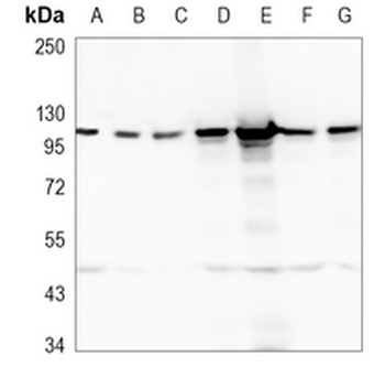 ACTN2 Rabbit Monoclonal Antibody