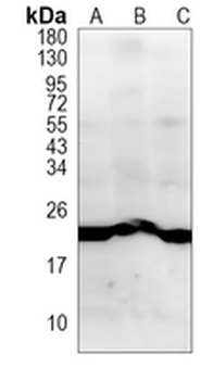 WFDC2 Rabbit Monoclonal Antibody