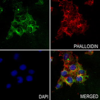 WFDC2 Rabbit Monoclonal Antibody