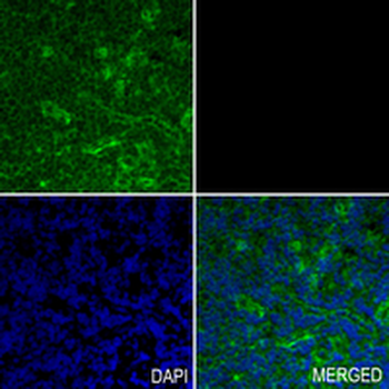 MYO1B Rabbit Monoclonal Antibody