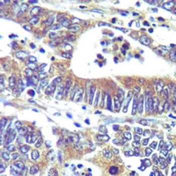 MHC class I Rabbit Monoclonal Antibody