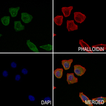MHC class I Rabbit Monoclonal Antibody