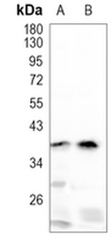 RGMA Rabbit Monoclonal Antibody