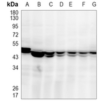 SEC61A2 Rabbit Monoclonal Antibody