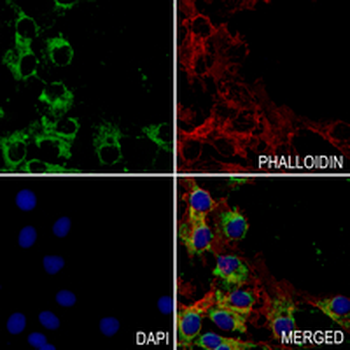 SEC61A2 Rabbit Monoclonal Antibody