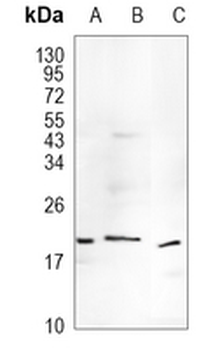 TIMM22 Rabbit Monoclonal Antibody
