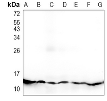Profilin 1 Rabbit Monoclonal Antibody
