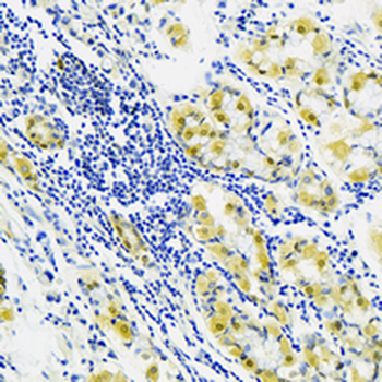 PCBD1 Rabbit Monoclonal Antibody