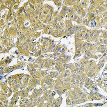 UBCH5 Rabbit Monoclonal Antibody