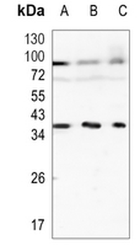 KLRG1 Rabbit Monoclonal Antibody