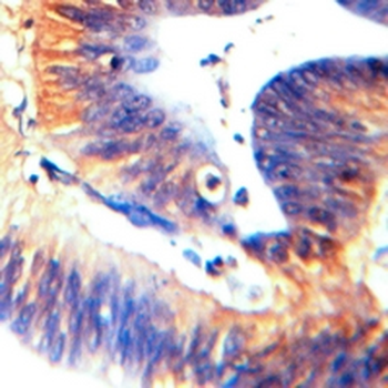 Clathrin Heavy Chain Rabbit Monoclonal Antibody